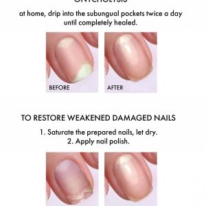 Antifungal 9 ml-nagu augšanas stimulators un pretsēnīšu līdzeklis