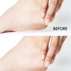 EMI Crack Treat Cream, 100 ml, krēms pret pēdu ādas plaisām